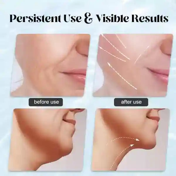 Before and after effects of a skincare product on skin texture.
