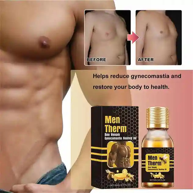 Advertisement for Men Therm product showing before and after effects on gynecomastia.