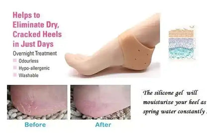 Silicone heel balm with before and after effects on a foot, showing dry skin and moisturized heel.