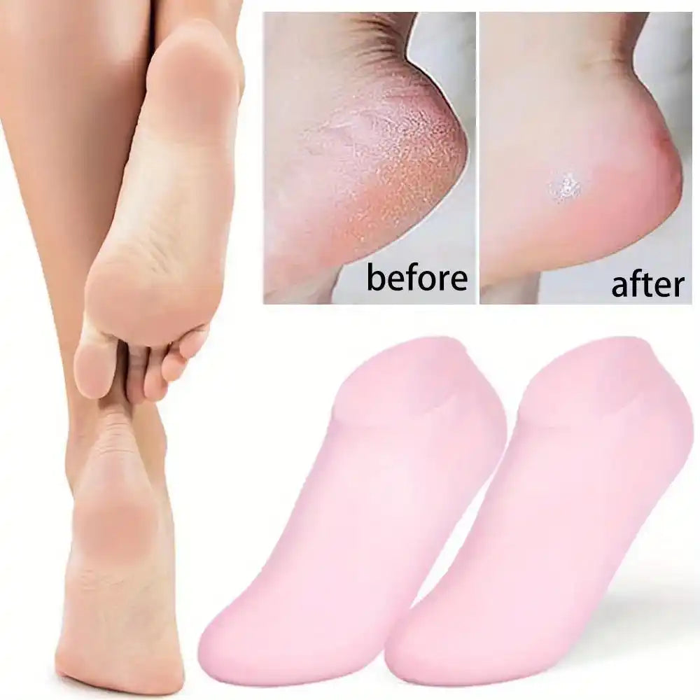 Before and after comparison of feet using pink socks on a white background