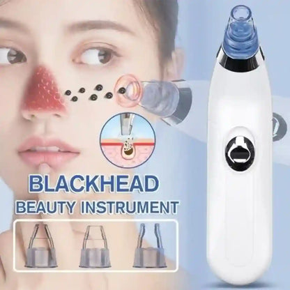 Blackhead removal tool with close-up of a nose and blackheads, on a light blue background.