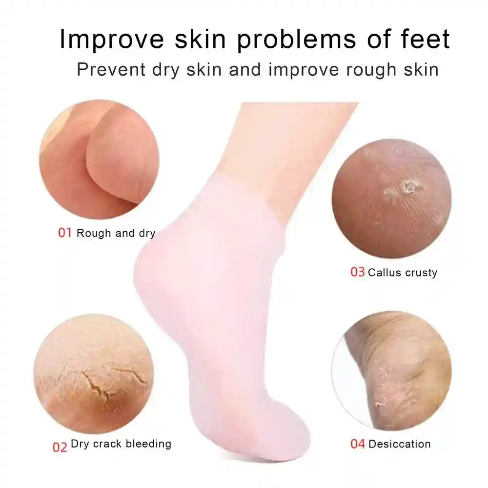 Product advertisement for foot care with images of dry and cracked skin and a foot wearing a sock.