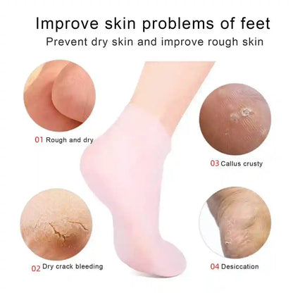 Product advertisement for foot care with images of dry and cracked skin and a foot wearing a sock.