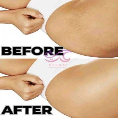 Before and after comparison of a person's legs with a visible brand logo.