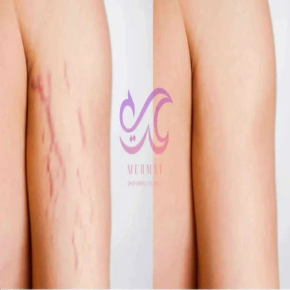 Before and after comparison of a scar removal treatment with a brand logo in the center.