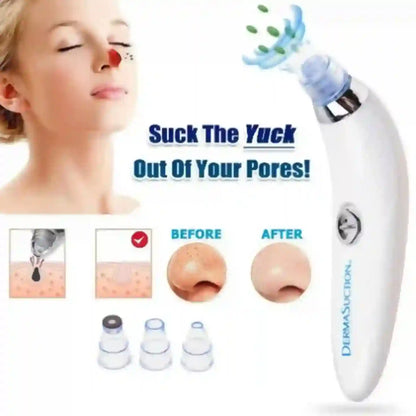 Pore cleaning device with before and after images on a white background