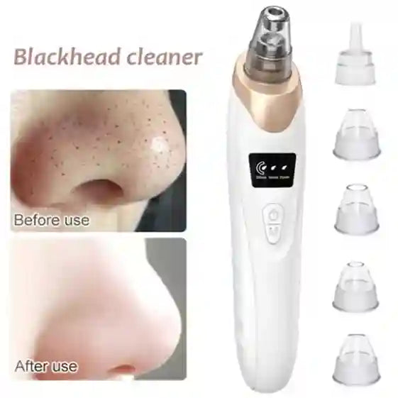 Blackhead cleaner with before and after use comparison on a white background