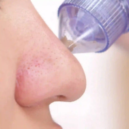 Nose with a small amount of liquid on it, close-up