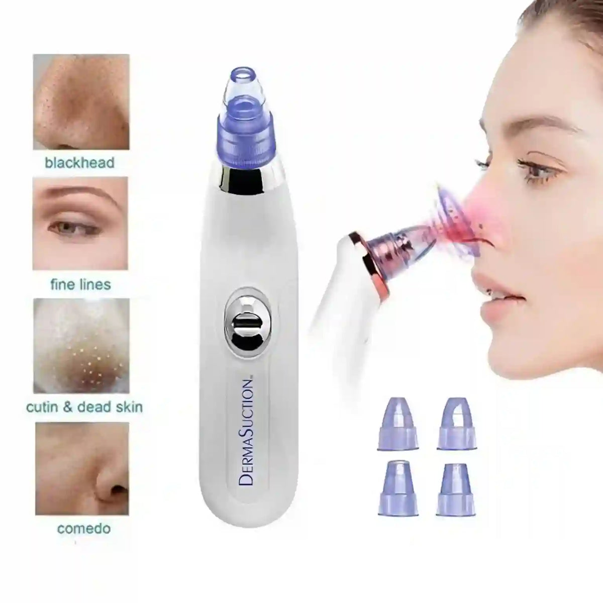 DermaSuction device with attachments and images of skin conditions it can treat.