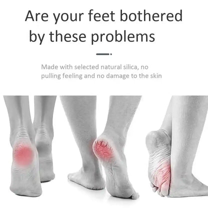 Feet with red spots and text about natural silica socks