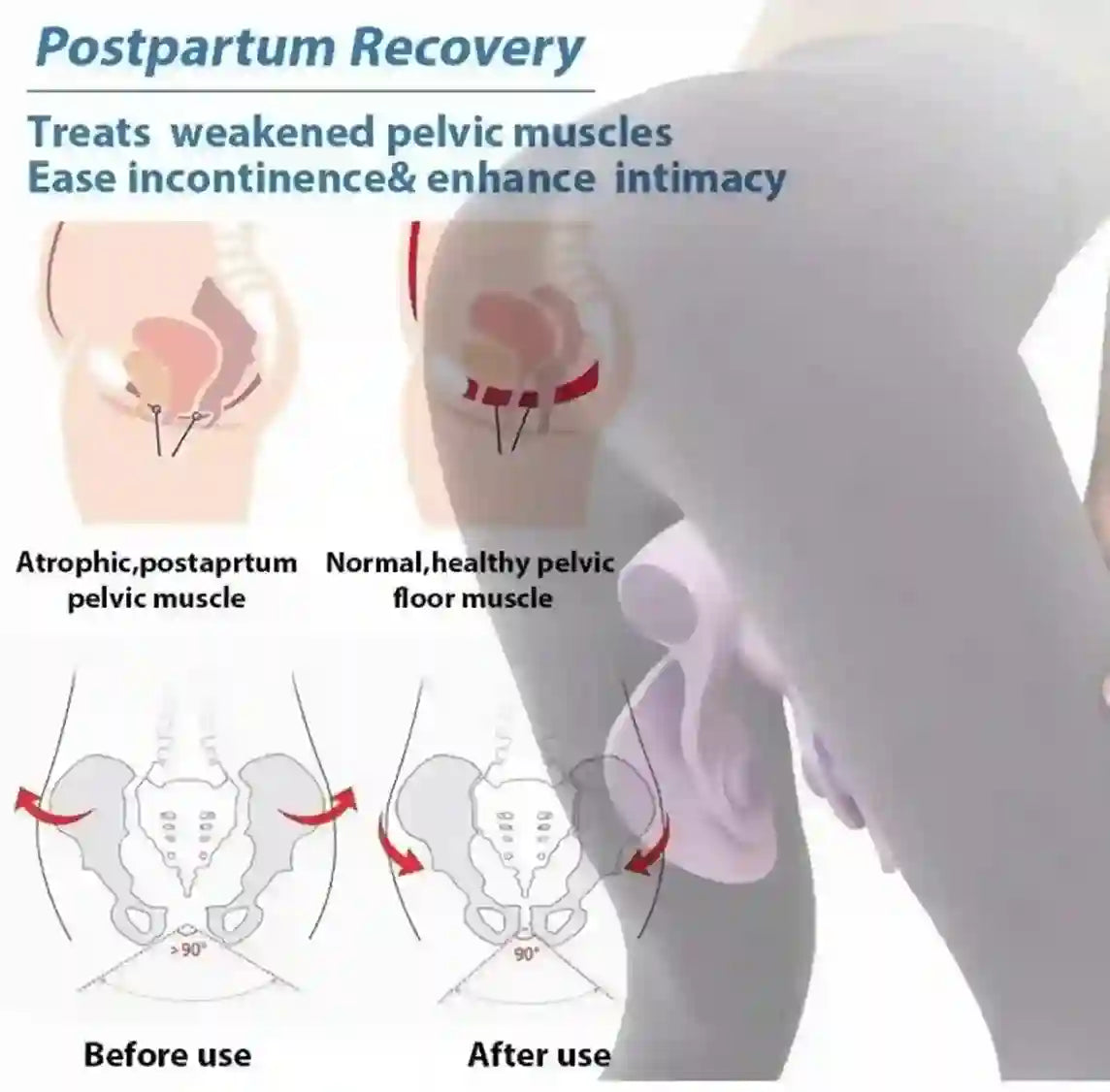 Diagram showing postpartum recovery with pelvic muscle before and after use.