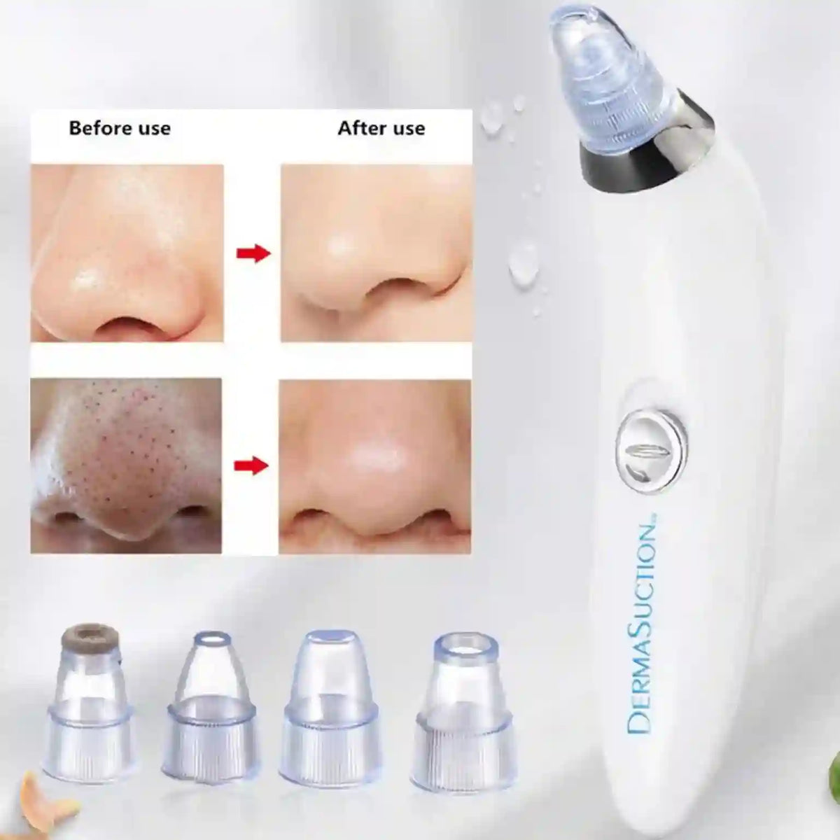 DermaSuction device with before and after use comparisons on a white background