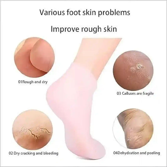 Foot skin problems with a product to improve rough skin