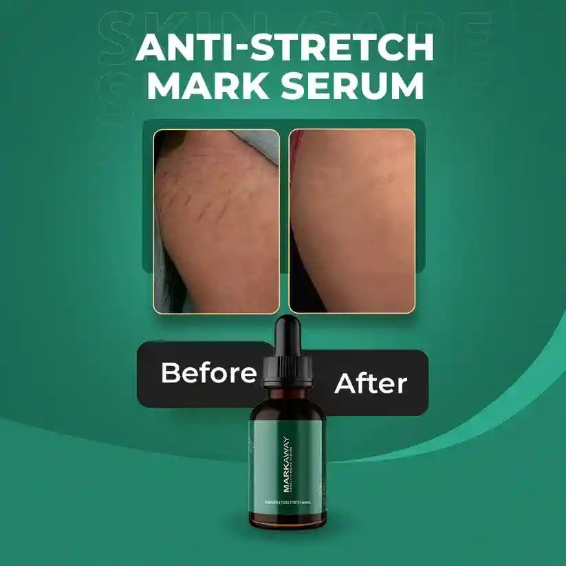 Anti-stretch mark serum bottle with 'Before' and 'After' skin comparison on a green background