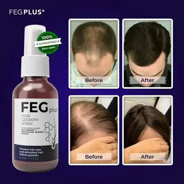 FEG Plus hair growth spray bottle with 'Before' and 'After' hair growth results on a blue background.