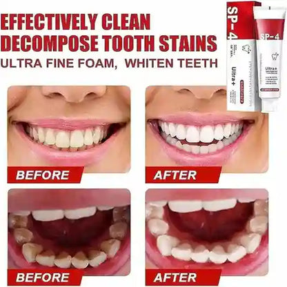 Before and after effects of a teeth whitening product with a tube labeled SP-4.