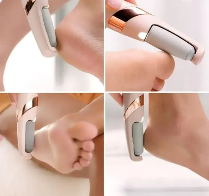 Collage of a handheld device being used on a foot, with close-up shots showing its design.