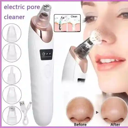 Electric pore cleaner with before and after effects on a woman's skin.