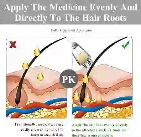 Illustration showing correct and incorrect application of medicine to hair roots with a focus on PK.