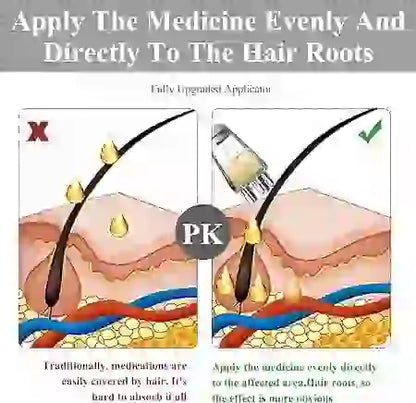 Illustration showing correct and incorrect application of medicine to hair roots with a focus on PK.