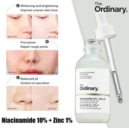 Skincare product with dropper labeled 'The Ordinary' and before-and-after skin comparisons.