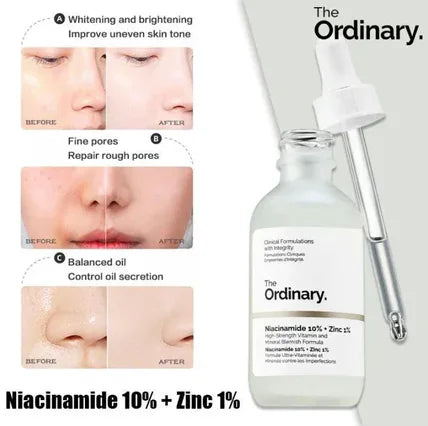Skincare product with dropper labeled 'The Ordinary' and before-and-after skin comparisons.