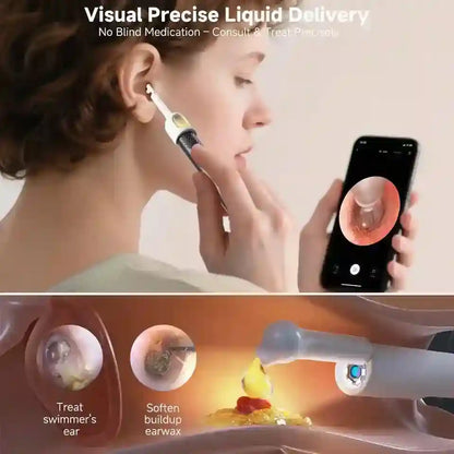 A promotional composite for an ear wax removal device. The top half shows a woman inserting a slim handheld tool into her ear while holding a smartphone displaying an ear interior view.