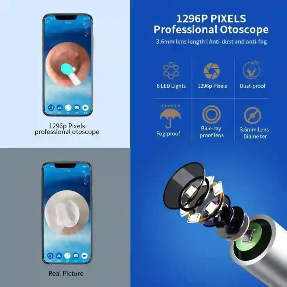Professional otoscope with smartphone app interface and product features on a blue background