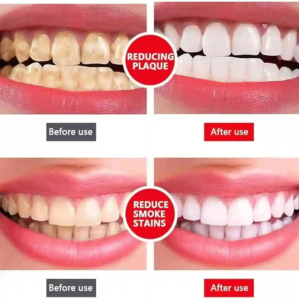 Before and after effect of using a dental product to reduce plaque and smoke stains.
