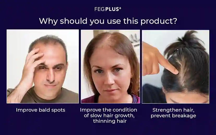 Advertisement for FEGPLUS hair product showing before-and-after effects on hair health.